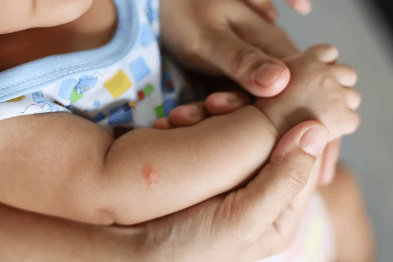 Trẻ có biểu hiện lờ đờ, chân tay lạnh ẩm là dấu hiệu tiền sốc cần đưa đi bệnh viện cấp cứu ngay.
